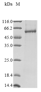 SDS-PAGE - Recombinant Human NOX1 protein (AB289772)