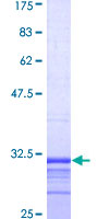 SDS-PAGE - Recombinant Human NOX2/gp91phox protein (GST tag N-Terminus) (AB114183)