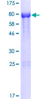 Recombinant Human NOXA1 protein