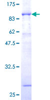 Recombinant Human NOXA2/p67phox protein
