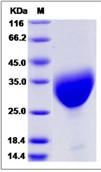 SDS-PAGE - Recombinant Human NPDC1 protein (His tag) (AB276575), expandable thumbnail
