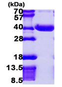 SDS-PAGE - Recombinant Human NPL protein (His tag N-Terminus) (AB106873)