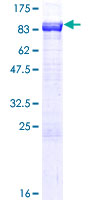 SDS-PAGE - Recombinant Human NPL4 protein (AB153405), expandable thumbnail
