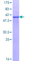 SDS-PAGE - Recombinant Human NPM2 protein (GST tag N-Terminus) (AB160962)