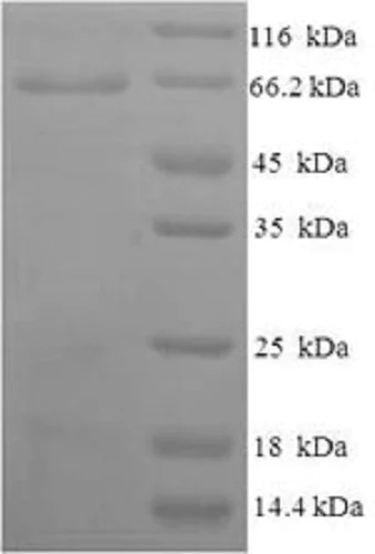 SDS-PAGE - Recombinant Human NPR-A protein (Tagged) (AB235810)