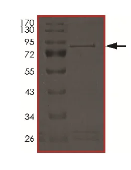 SDS-PAGE - Recombinant Human NPR-B protein (AB201371)