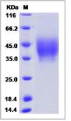 SDS-PAGE - Recombinant Human NPTN protein (His tag) (AB276693)