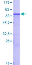 Recombinant Human NPTX2 protein