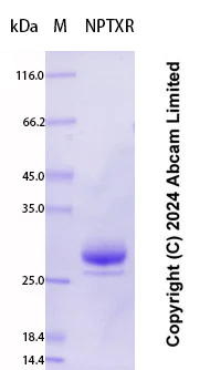 SDS-PAGE - Recombinant Human NPTXR Protein Standard (His tag) (AB323029)