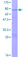 SDS-PAGE - Recombinant Human NR2F2 protein (AB159680), expandable thumbnail