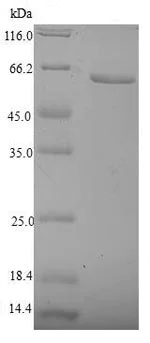 SDS-PAGE - Recombinant Human NR2F6/EAR-2 protein (Tagged) (AB235796)