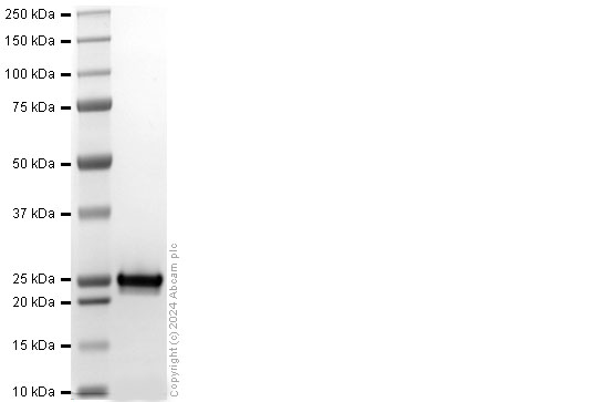 SDS-PAGE - Recombinant Human NRAS (mutated G12D) Protein (His tag) (AB318947), expandable thumbnail