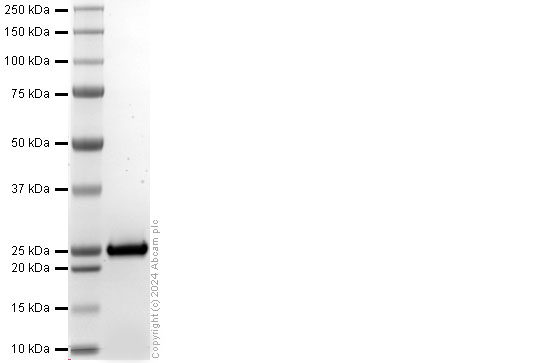 SDS-PAGE - Recombinant Human NRAS (mutated Q61K) Protein (His tag) (AB318946), expandable thumbnail