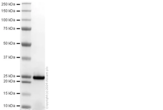 SDS-PAGE - Recombinant Human NRAS(mutated Q61R) Protein (His tag) (AB318945)