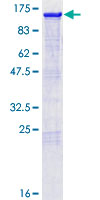 SDS-PAGE - Recombinant Human Nrf2 protein (AB132356), expandable thumbnail