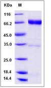 SDS-PAGE - Recombinant Human NRG1 type II protein (Fc Chimera) (AB276410), expandable thumbnail