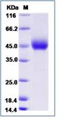 SDS-PAGE - Recombinant Human NRG2 protein (His tag) (AB276735)