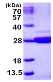 SDS-PAGE - Recombinant Human NRK1 protein (His tag N-Terminus) (AB126673)