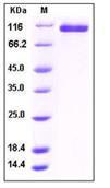 SDS-PAGE - Recombinant human NRP2 protein (Fc Chimera) (AB276305), expandable thumbnail
