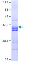 SDS-PAGE - Recombinant Human NRP2 protein (GST tag N-Terminus) (AB160214)