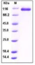 SDS-PAGE - Recombinant Human NRP2 protein (His tag) (AB276306)