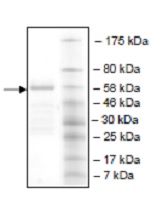 SDS-PAGE - Recombinant Human NSD3 protein (AB196390)