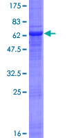 SDS-PAGE - Recombinant Human NSDHL protein (AB162360), expandable thumbnail