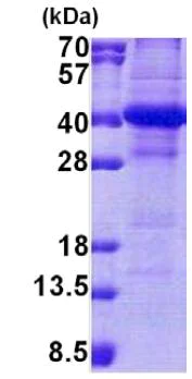 SDS-PAGE - Recombinant Human NSL1 protein (denatured) (His tag N-Terminus) (AB167875)