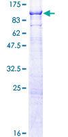 Recombinant Human NSMase2 protein