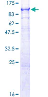 SDS-PAGE - Recombinant Human NSMase2 protein (AB112416)