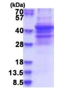 SDS-PAGE - Recombinant Human NSP 5 alpha 3 alpha protein (His tag N-Terminus) (AB181917)