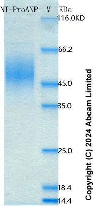 SDS-PAGE - Recombinant Human NT-ProANP Protein Standard (AB316696)