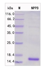 SDS-PAGE - Recombinant Human NT-proBNP Protein Standard (His tag) (AB316391), expandable thumbnail