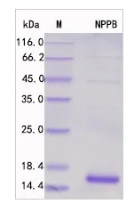 SDS-PAGE - Recombinant Human NT-proBNP Protein Standard (His tag) (AB316391)
