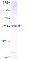 Recombinant Human NT2NL protein