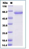 SDS-PAGE - Recombinant Human NT2NL protein (Fc Chimera) (AB276626)