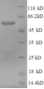 SDS-PAGE - Recombinant Human NT5C1A protein (His tag) (AB241514)