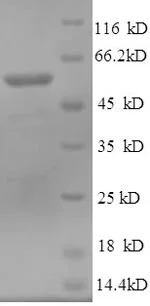 SDS-PAGE - Recombinant Human NT5C1A protein (His tag) (AB241514)
