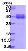 SDS-PAGE - Recombinant Human NT5C3L protein (AB187423)