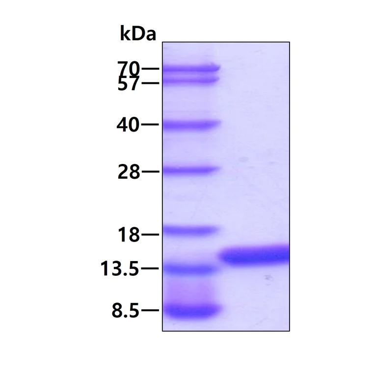 SDS-PAGE - Recombinant Human NTF2 protein (His tag N-Terminus) (AB99139)