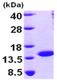 SDS-PAGE - Recombinant Human NTF2 protein (His tag N-Terminus) (AB99139)