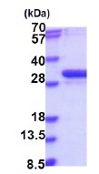 SDS-PAGE - Recombinant Human NUBP2 protein (AB187482), expandable thumbnail