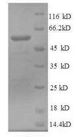 Recombinant Human Nucleolin protein (His tag)