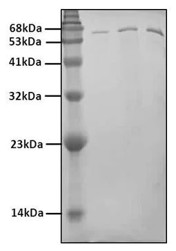 SDS-PAGE - Recombinant Human Nucleophosmin protein (AB285794)