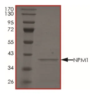 SDS-PAGE - Recombinant Human Nucleophosmin protein (His tag) (AB268818)