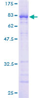 Recombinant Human Nucleoporin p62/NUP62 protein