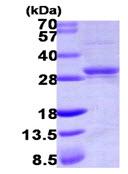 SDS-PAGE - Recombinant Human Nucleoside-diphosphate kinase protein (His tag N-Terminus) (AB105612)