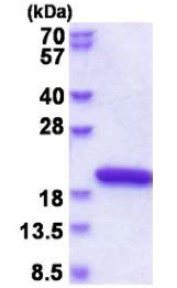 SDS-PAGE - Recombinant Human NUDCD2 protein (His tag N-Terminus) (AB177724)