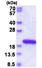 SDS-PAGE - Recombinant Human NUDCD2 protein (His tag N-Terminus) (AB177724)
