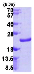 SDS-PAGE - Recombinant Human NUDT10 protein (His tag C-Terminus) (AB106890)